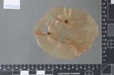 A photograph of the species Fusarium culmorum, not of this specimen