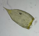 A photograph of the species Platygyrium repens, not of this specimen