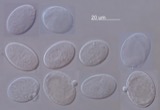 A photograph of the species Peronospora parasitica, not of this specimen