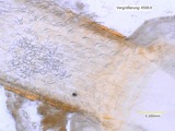 A photograph of the species Echinorhynchus Zoega, not of this specimen